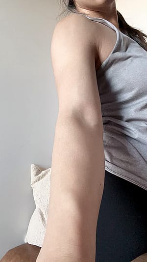 thecaringdoc - some arm stuff'